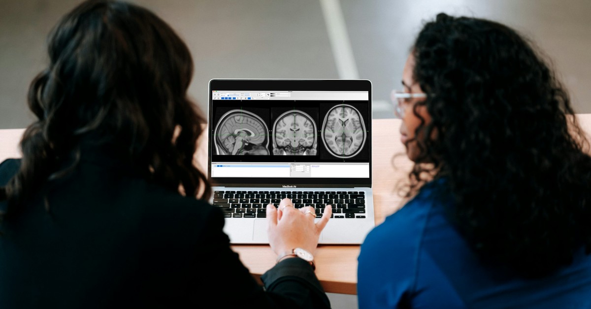 Two professionals analysing AI-powered brain scans on a laptop: AI as a medical device under MDR and EU AI Act